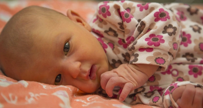 زردی نوزاد را چگونه تشخیص دهیم و درمان کنیم؟