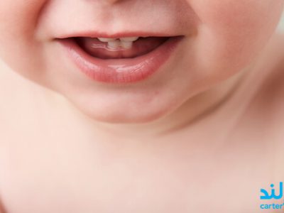 دندان در آوردن نوزاد